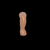 Atypical/Complex Clubfoot Model